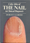 Color Atlas of the Nail in Clinical Diagnosis (1996).