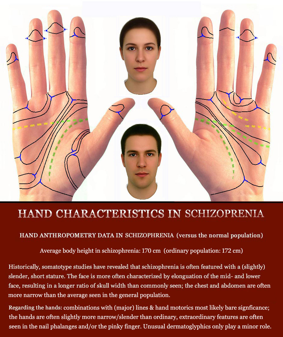 Schizophrenia & the hand: multi-perspective palm reading.