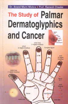 The Study of Palmar Dermatoglyphics and Cancer.